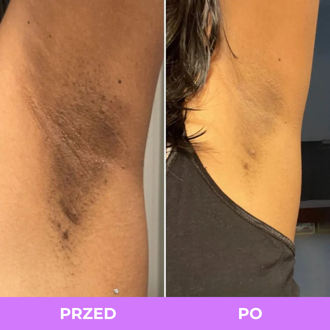 Spray z Kurkumą i Kwasem Kojowym Arelia
