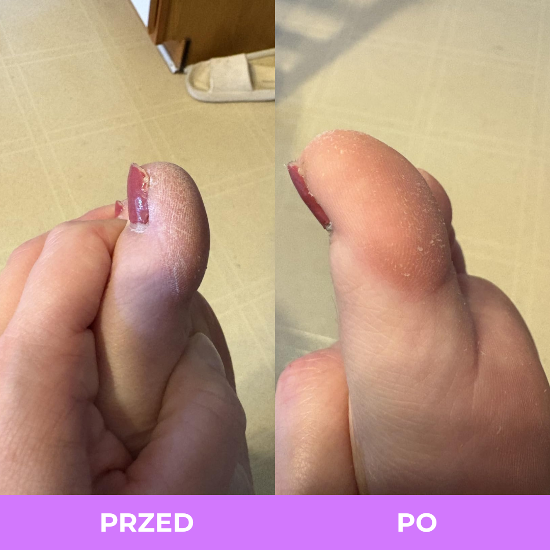 Spray z Kurkumą i Kwasem Kojowym Arelia